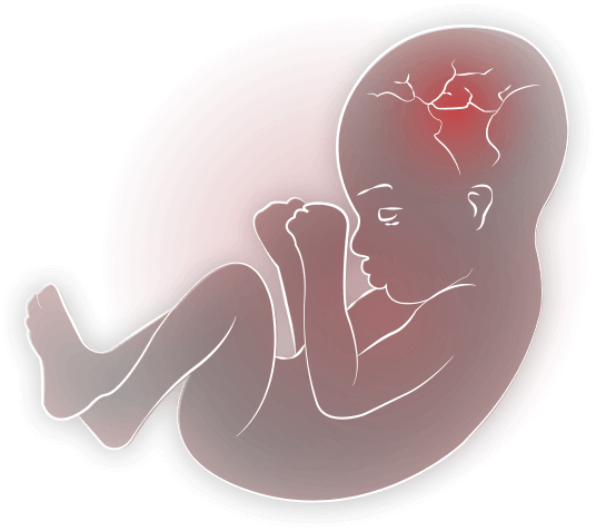 Baby In Womb. U201C - Baby In Womb, Transparent background PNG HD thumbnail