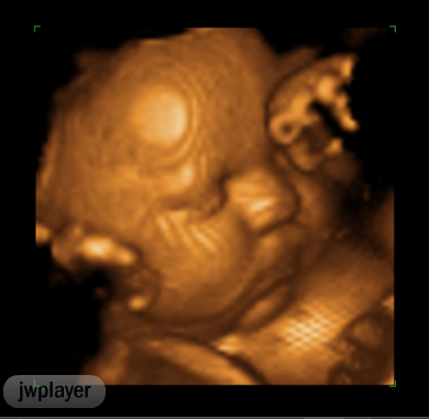 Cute baby ultrasound with suc