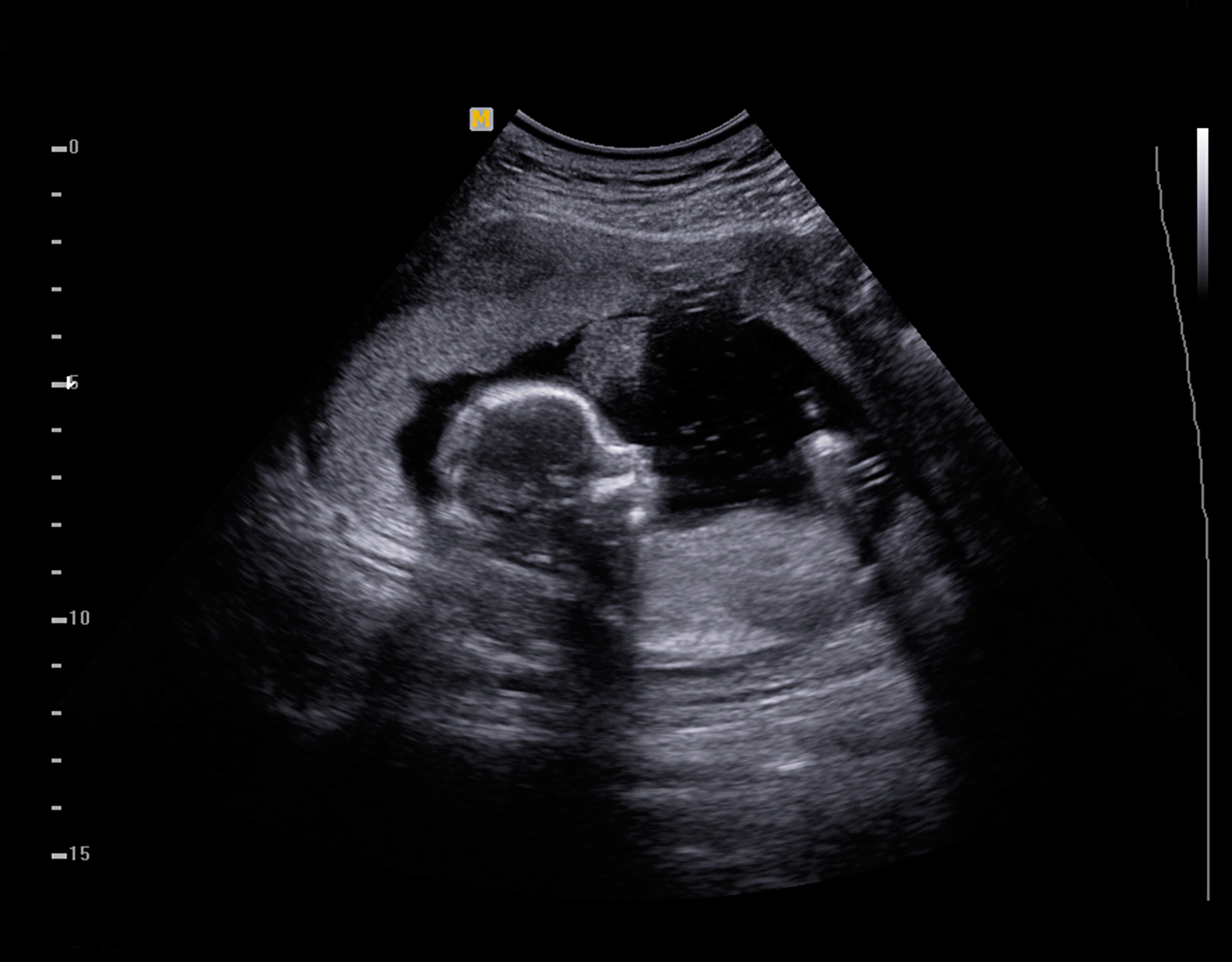 If You Have Kids, Thereu0027S A Good Chance That The Very First Time You Laid Eyes On Them Was Via A U201Csonogramu201D Image Taken Before They Were Even Born. - Baby Ultrasound, Transparent background PNG HD thumbnail