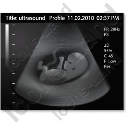 Baby boy ultrasound picture.P