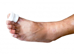 Foot And Toe Fractures - Big Toe, Transparent background PNG HD thumbnail