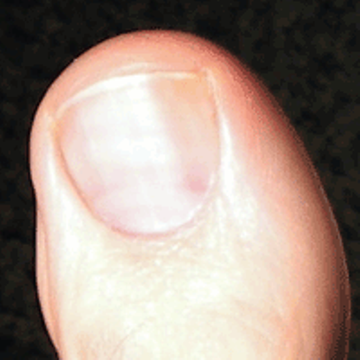 This Talk Revolves Around The Big Toe, That Part Of The Human Body Which, In Evolutionary Terms, Is Most Distinct From The Anatomy Of Apes, Hdpng.com  - Big Toe, Transparent background PNG HD thumbnail