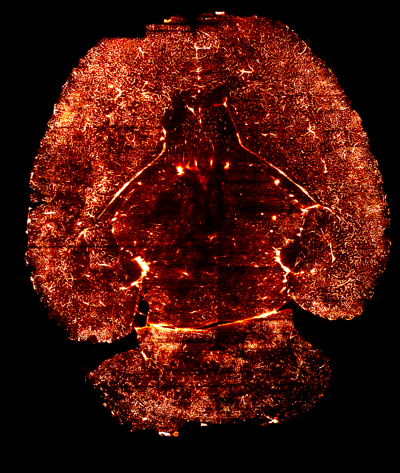 File:blood Vessels Mouse Brain Section.png - Blood Vessels, Transparent background PNG HD thumbnail