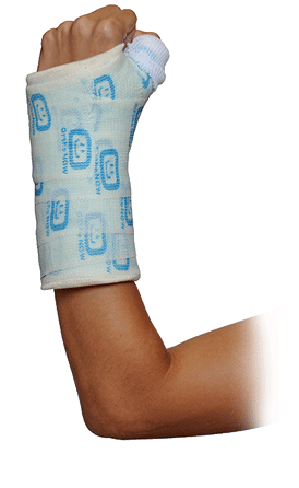 Broken Elbow Png - Arm, Transparent background PNG HD thumbnail