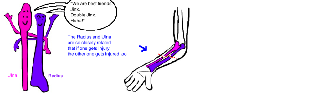 Broken Forearm In Children Bbfa Fracture - Broken Elbow, Transparent background PNG HD thumbnail