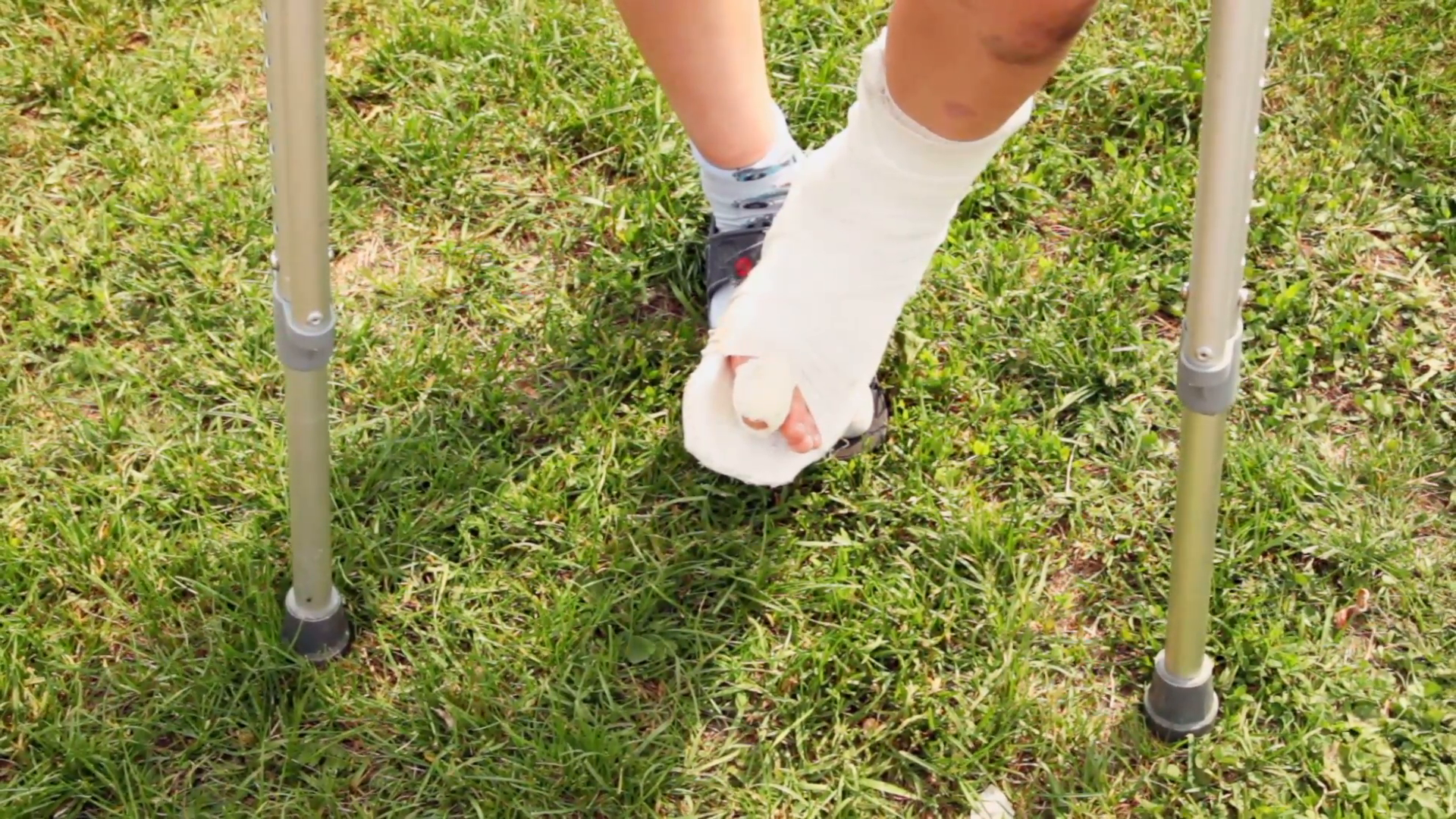 Boy Makes Steps By Injured Leg With Broken Finger Stock Video Footage   Videoblocks - Broken Leg, Transparent background PNG HD thumbnail