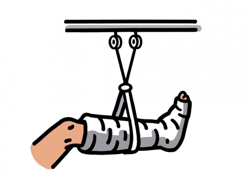 Broken Foot Clipart Broken Foot Clipart Broken Leg Clipart Clipart Kid 605 X 466 - Broken Leg, Transparent background PNG HD thumbnail