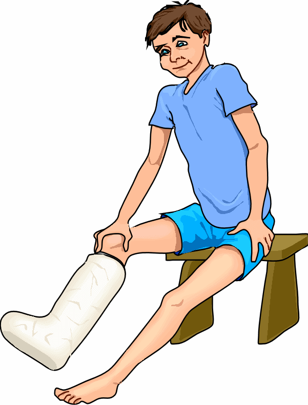 Cartoon Broken Leg   Clipart Library - Broken Leg, Transparent background PNG HD thumbnail