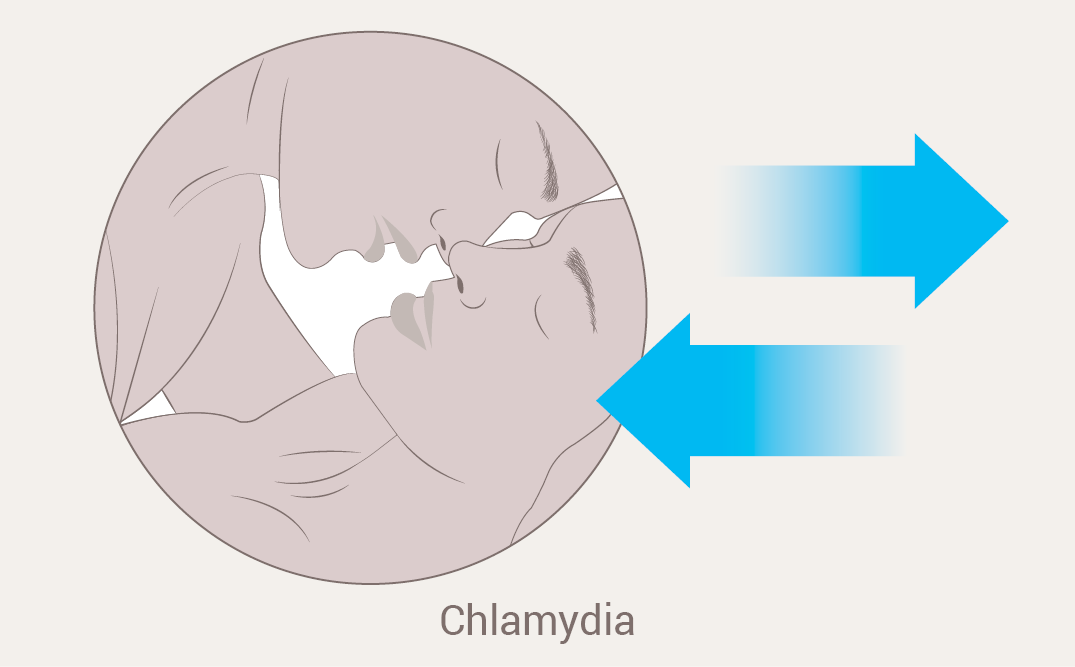 Factsheet Chlamydia - Chlamydia, Transparent background PNG HD thumbnail