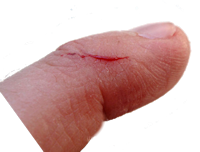 Cut Finger - Cut Finger, Transparent background PNG HD thumbnail
