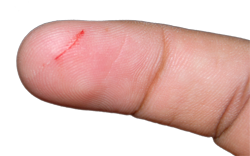 Everyone Gets Minor Cuts And Scrapes. Itu0027S Part Of Living. - Cut Finger, Transparent background PNG HD thumbnail