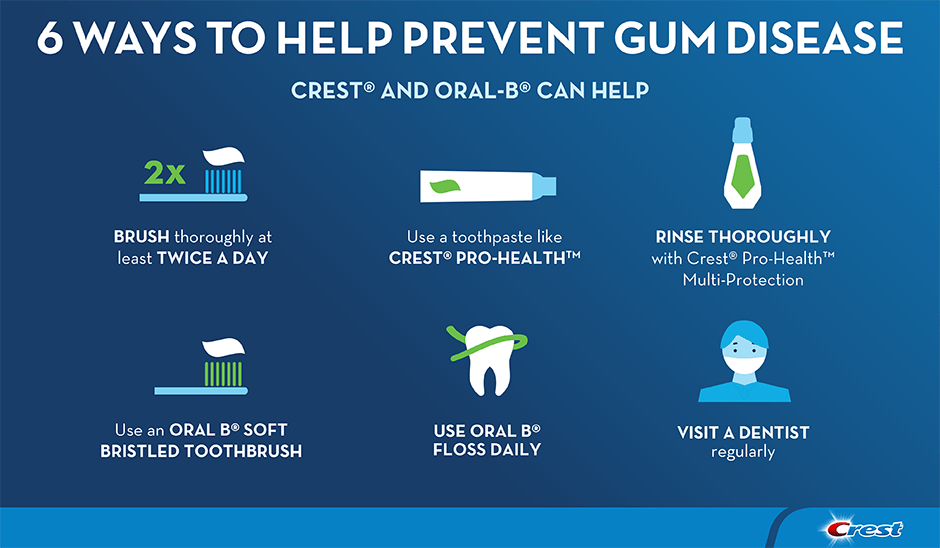 6 Ways To Prevent Gum Disease At Home - Dental Health, Transparent background PNG HD thumbnail
