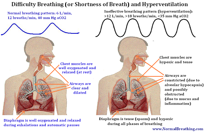 Shortness Of Breath (Difficulties Breathing) And Hypocapnia - Difficulty Breathing, Transparent background PNG HD thumbnail