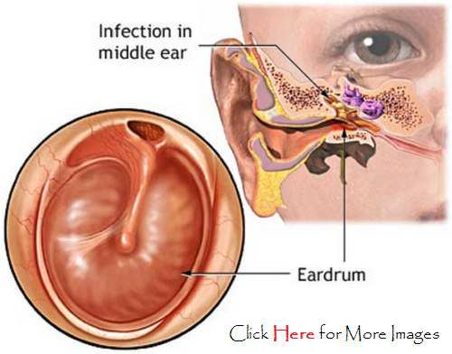 disease, ear, infection, pain