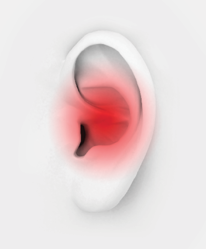 Ear Infection Frustration: This Common Childhood Ailment Can Be Difficult To Diagnose, Treat. - Ear Infection, Transparent background PNG HD thumbnail