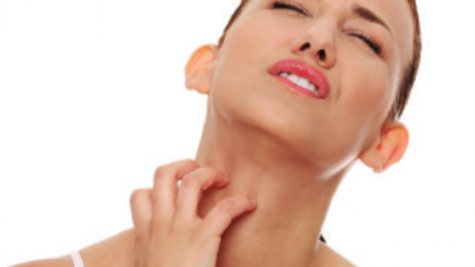 Alternatives For Eczema Image - Eczema, Transparent background PNG HD thumbnail