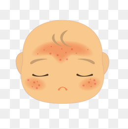 Cartoon Baby Eczema, Cartoon Eczema, Baby Eczema, Hospital Icon Png Image - Eczema, Transparent background PNG HD thumbnail