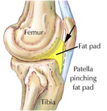 Fat Woman With Knee Pain PNG - Fat Woman With Knee Pa