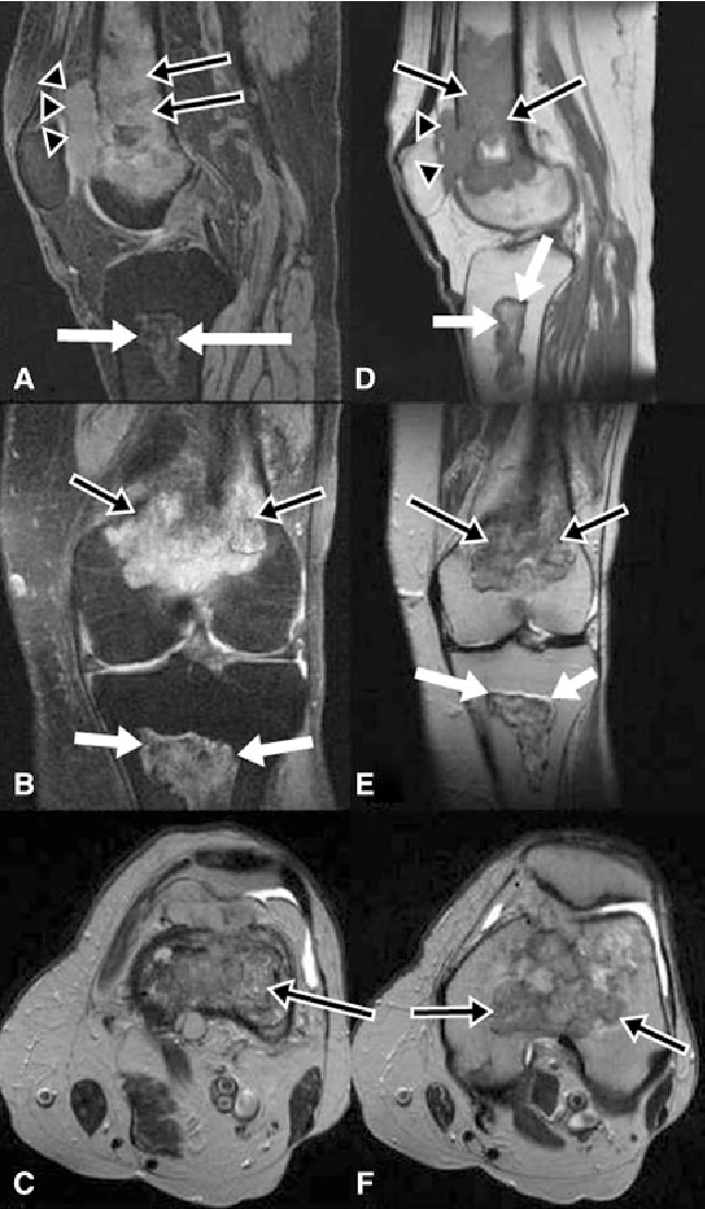 Fat Woman With Knee Pain PNG - 2Au2013F (A) Sagittal 