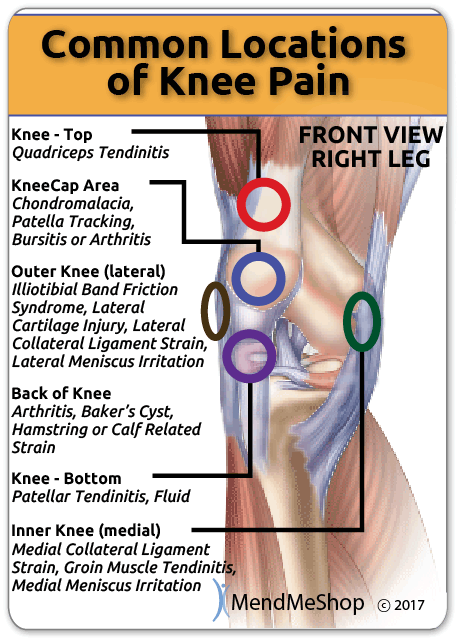 Fat Woman With Knee Pain PNG - Knee Pain Can Occur At