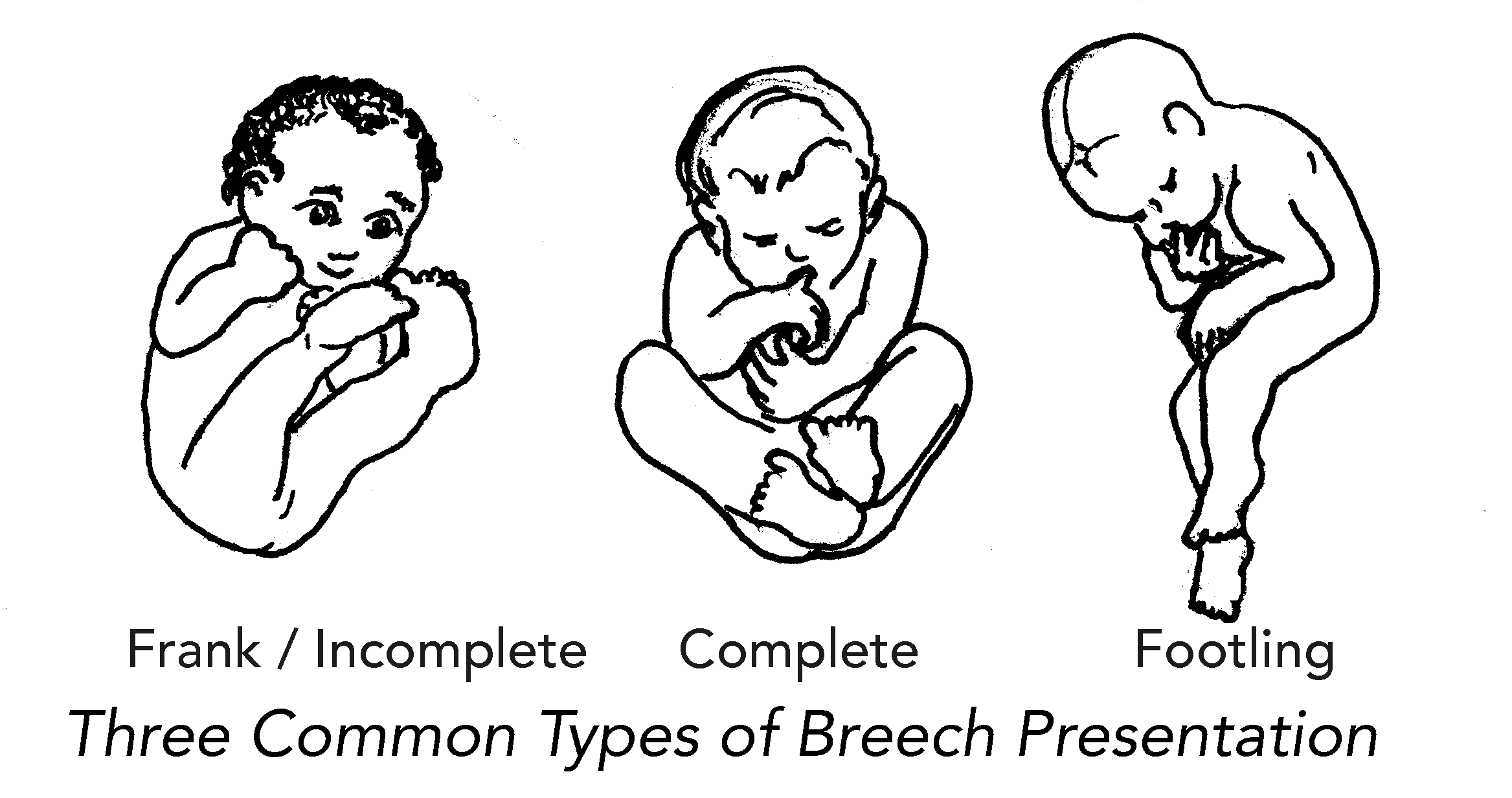 Baby position in 8th month of