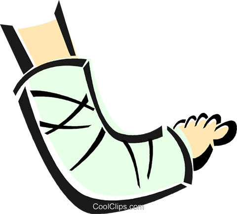Broken Arm In A Cast Royalty Free Vector Clip Art Illustration - Gipsarm, Transparent background PNG HD thumbnail