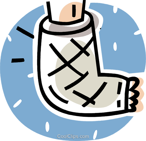 Broken Foot In A Cast Royalty Free Vector Clip Art Illustration - Gipsarm, Transparent background PNG HD thumbnail