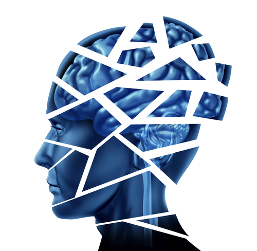 Traumatic Brain Injury Research - Head Injury, Transparent background PNG HD thumbnail