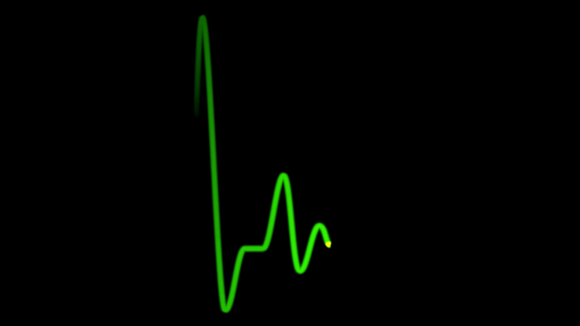 Green Heart Pulse Line. Animation Of Ekg Heart Beat On Black Background, Loopable, Alpha Channel Included Motion Background   Videoblocks - Heart Beat, Transparent background PNG HD thumbnail