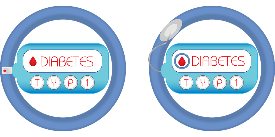 Diabetes Type 1 Also Known As, Diabetes Mellitus Or Juvenile Diabetes Is A Serious Condition That Is Common Among Children And Teenagers. - Juvenile Diabetes, Transparent background PNG HD thumbnail
