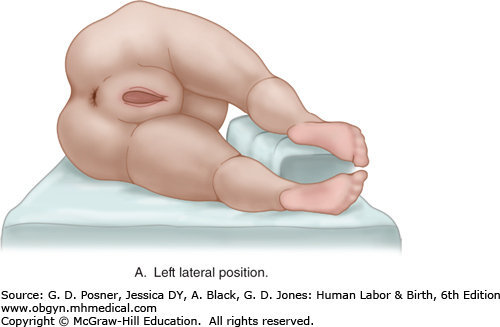 Image Not Available. - Labor Birth, Transparent background PNG HD thumbnail