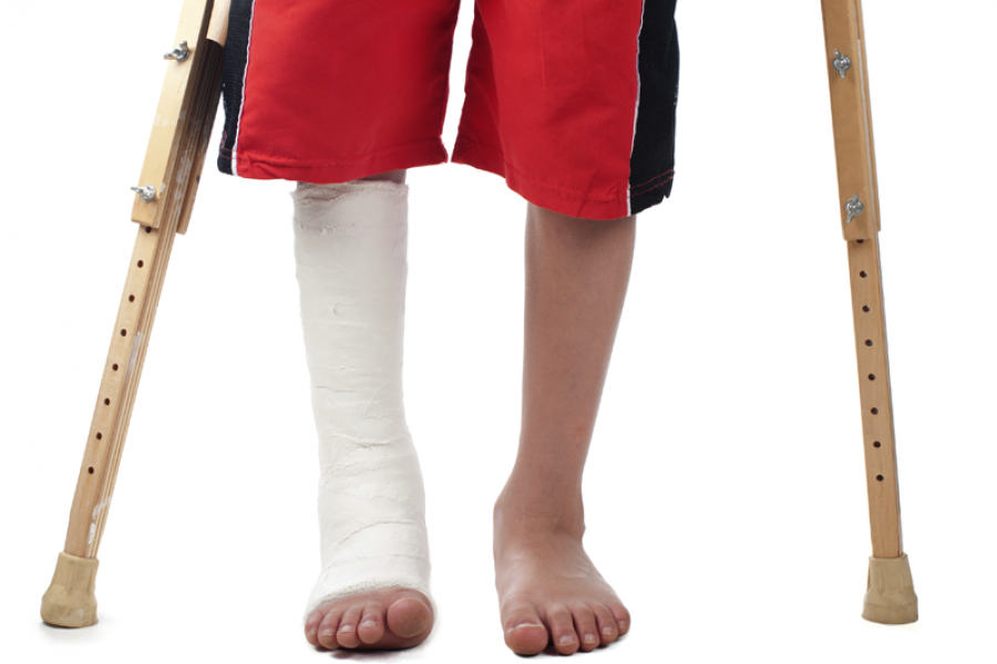00_Medical_Device_Tax_02.png. Child With Leg In Cast Hdpng.com  - Leg Cast, Transparent background PNG HD thumbnail