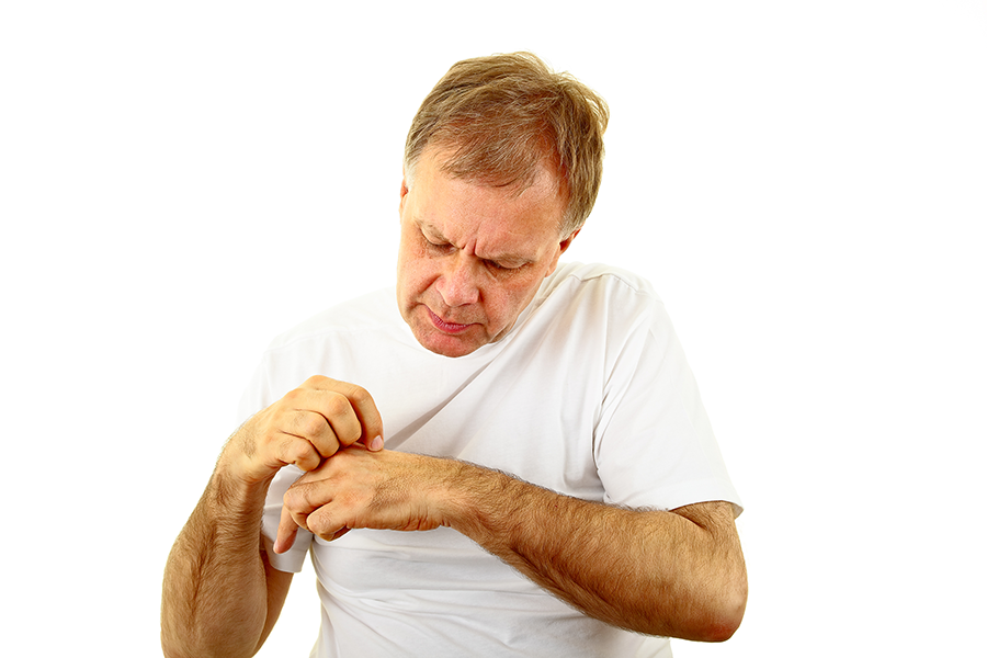 Man Itching Mosquito Bite In White Shirt - Mosquito Bite, Transparent background PNG HD thumbnail