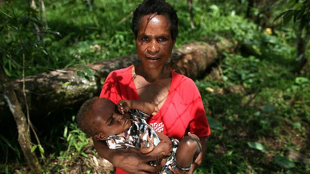 Mother Of Six, Wendy Daniell, With Her One Year Old Son, Pictured Next To The Log She Used To Prop Her Legs Up While Giving Birth In Papua New Guinea. - Mother Giving Birth, Transparent background PNG HD thumbnail