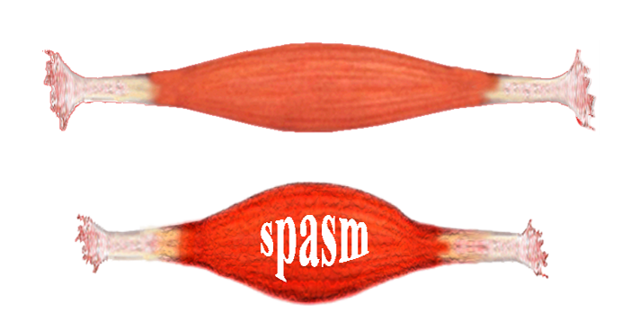 Muscle Tissue Png - Relaxed_And_Spasmed, Transparent background PNG HD thumbnail