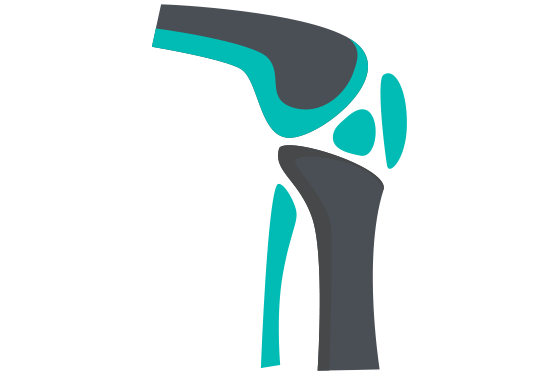 Illustration Of The Knee - Orthopedics, Transparent background PNG HD thumbnail