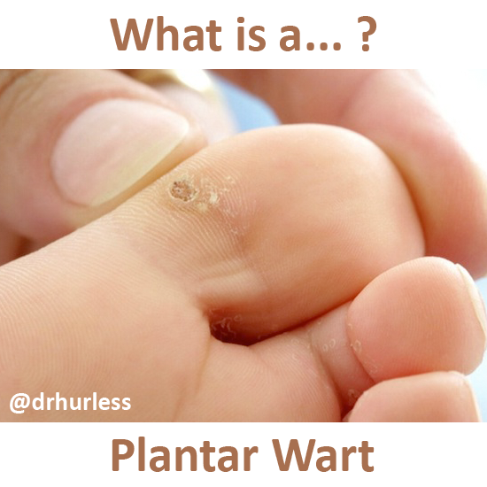 Planters Wart Png Hdpng.com 550 - Planters Wart, Transparent background PNG HD thumbnail