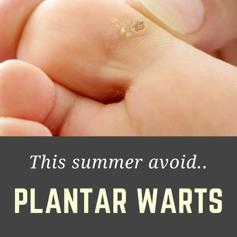 Plantar Warts Are A Special Type Of Wart That Is Most Common Among Kids And Teens. They Start Out As Small Lesions On The Bottom Of The Foot That Look A Bit Hdpng.com  - Planters Wart, Transparent background PNG HD thumbnail