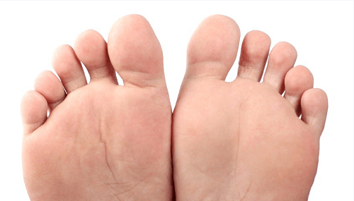 What Does a Plantar Wart Look