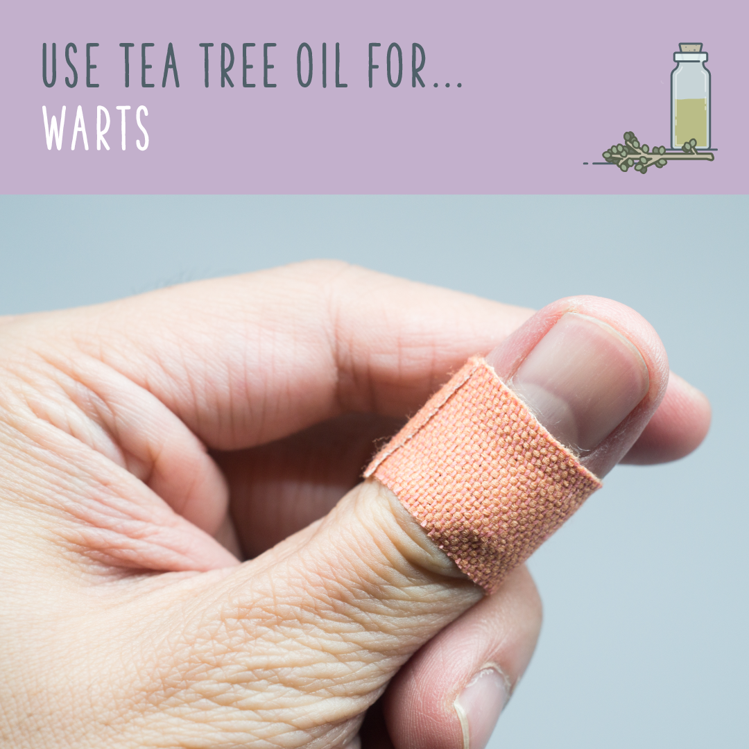 Tea Tree Oil For Warts For Plantar, Flat, And Common Warts, Tea Tree - Planters Wart, Transparent background PNG HD thumbnail