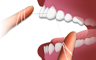 For Areas Between The Teeth That A Toothbrush Canu0027T Reach, Dental Floss Is Used To Remove Food Particles And Plaque. Dental Floss Is A Thin Thread Of Waxed Hdpng.com  - Dental Floss, Transparent background PNG HD thumbnail
