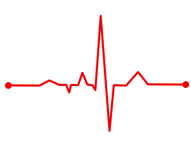 Heart Rate, Bpm, Ecg, Ekg, Electrocardiogram, Ecg Waves - Ekg, Transparent background PNG HD thumbnail