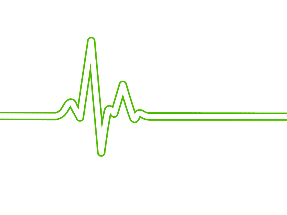 Heart Rate, Bpm, Ecg, Ekg, Electrocardiogram, Ecg Waves - Ekg, Transparent background PNG HD thumbnail