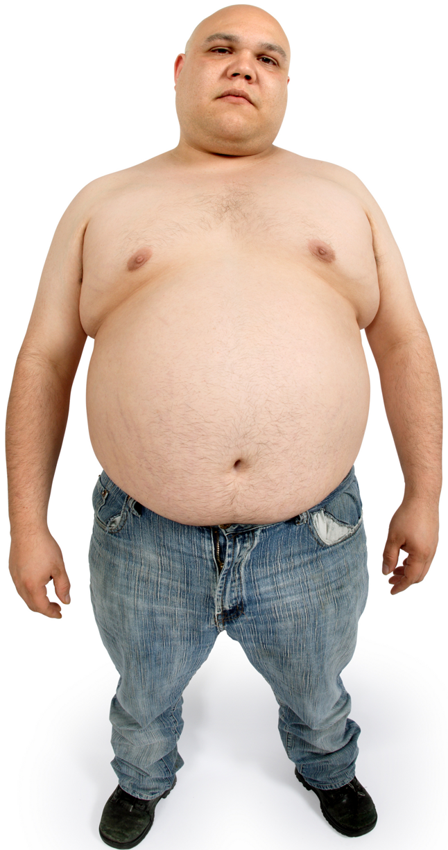 Png Fat Man - Malabsorption Is A General Term For, U201Cfailure To Absorbu201D. For This Article, Malabsorption Means The Failure Of The Gi Tract, (Basically The Small Intestine) Hdpng.com , Transparent background PNG HD thumbnail