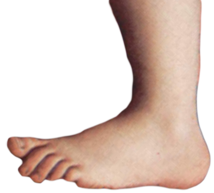 File:monty Python Foot.png - Toe, Transparent background PNG HD thumbnail