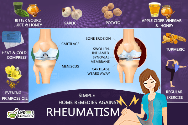Causes of Rheumatism