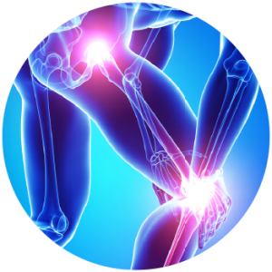 Rheumatoid Arthritis (Introdu