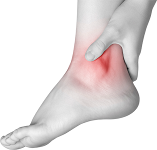 Ankle Pain Refers To Any Type Of Discomfort In Your Ankles. This Pain Could Be Caused By An Injury, Like A Sprain Such As Arthritis. - Sprained Ankle, Transparent background PNG HD thumbnail