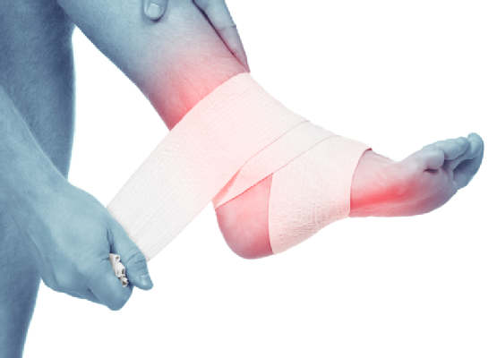 Ankle Sprain - Sprained Ankle, Transparent background PNG HD thumbnail