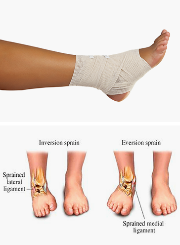 Ankle injuries and tennis